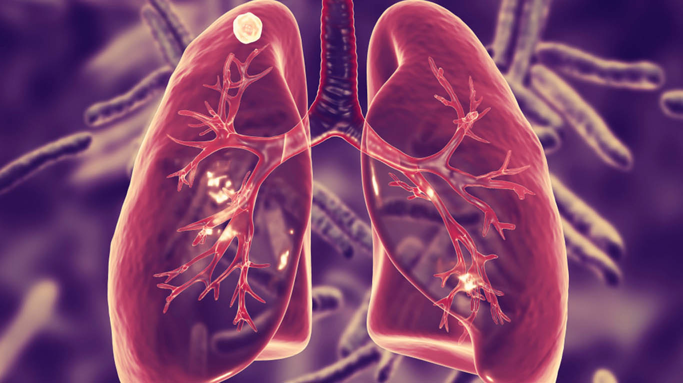Best Doctor for Wheezing in Teynampet
