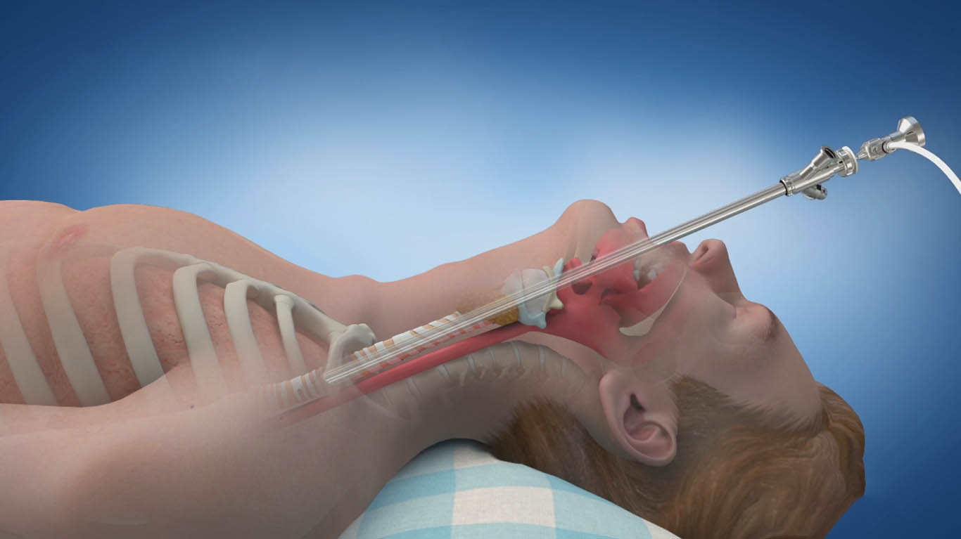 Best Doctor for Wheezing in Teynampet